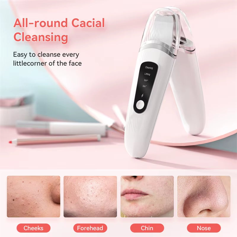 Ultrasonic Skin Scrubber Facial Skin Exfoliator Scraper and Pore Cleaner Facial Deep Cleansing