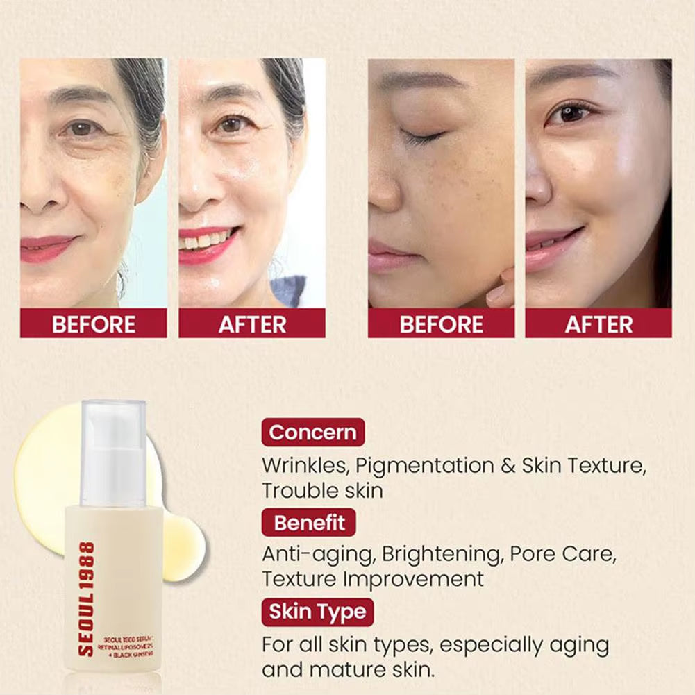 K-SECRET SEOUL 1988 Retinal Serum – Formulated with Advanced Retinal Liposome 2% and 58% Black Ginseng Extract | Fine Lines and Skin Texture Care Serum | Korean Skincare
